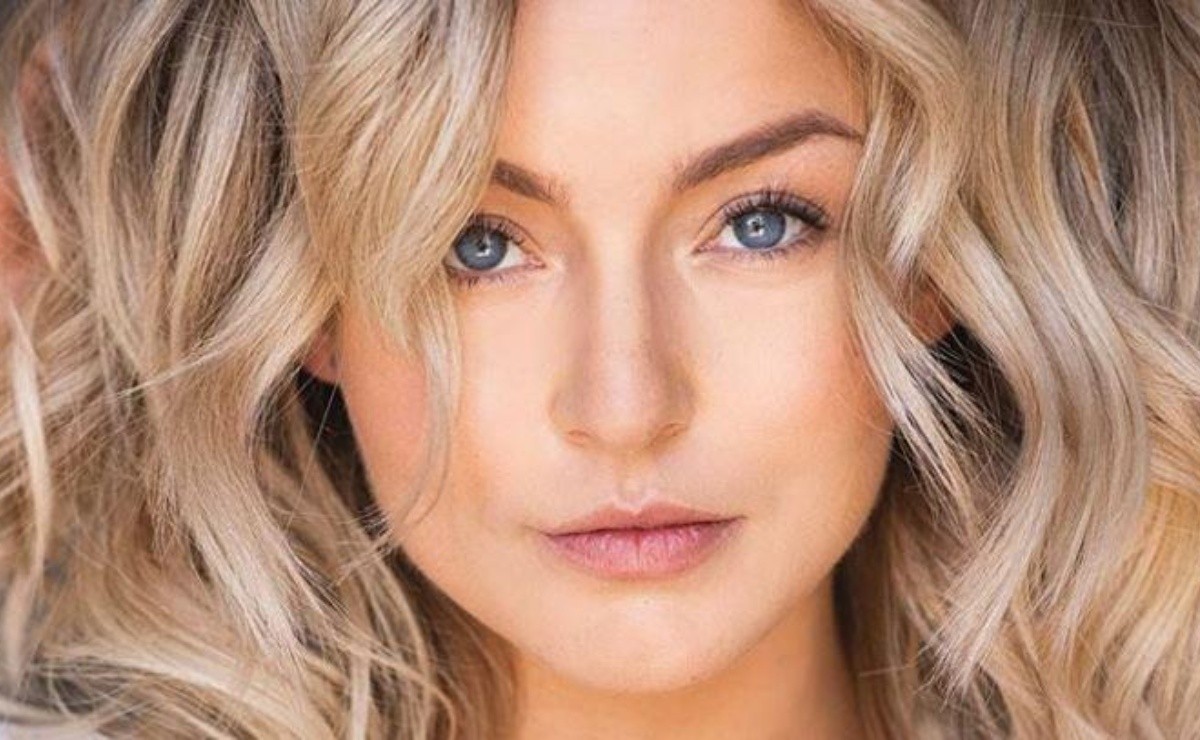 Angelique Boyer and the truth about the cleft lip PHOTO